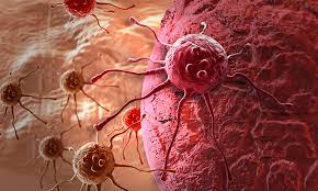 Journal of Oncology Case Reports Online