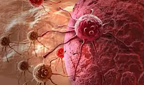 Journal of Oncology Case Reports Online