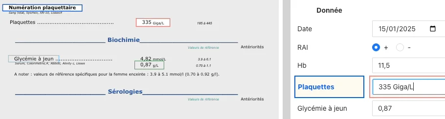 Analyses automatiques des données d'un bilan de grossesse par l'intelligence artificielle pour sages-femmes