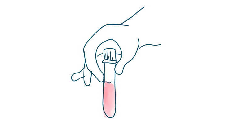 media-card-hand-blood-vial-know-more-sooner-allosure-kidney-d