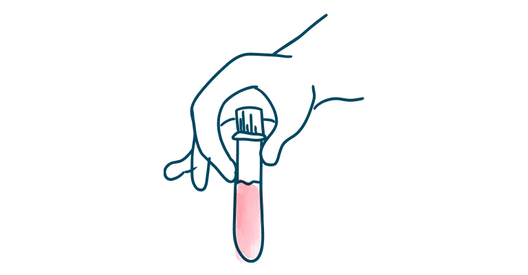 media-card-small-hand-holding-blood-vial-kidney-monitoring-after-transplant-d