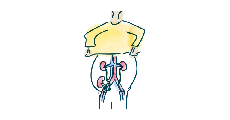 media-card-body-kidneys-understanding-kidney-transplant-rejection-d