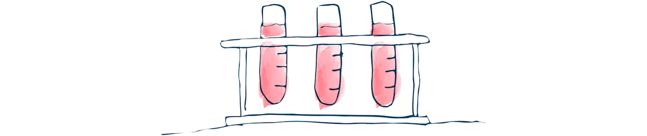 media-blood-test-understanding-kidney-transplant-rejection-d