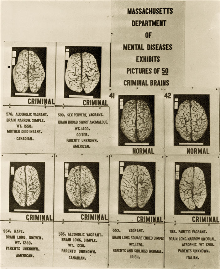 Photographs of fifty “criminal brains” from an exhibit by the Massachusetts Department of Mental Diseases, 1921. Source: Cold Spring Harbor Laboratory Archives, via National Library of Medicine.