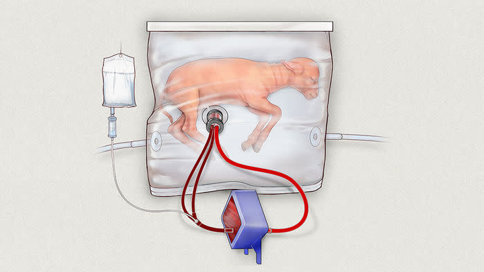A rendering of a "bio-bag" with a sheep fetus inside. 