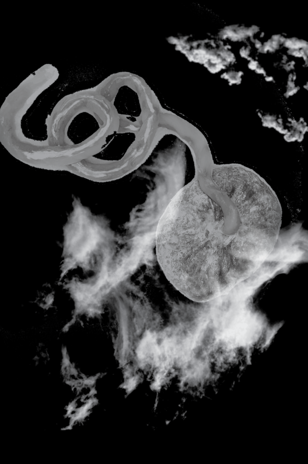 An abstract interstitial image with a placenta and umbilical cord.