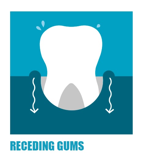 symptoms-of-gum-problems-receding-gums