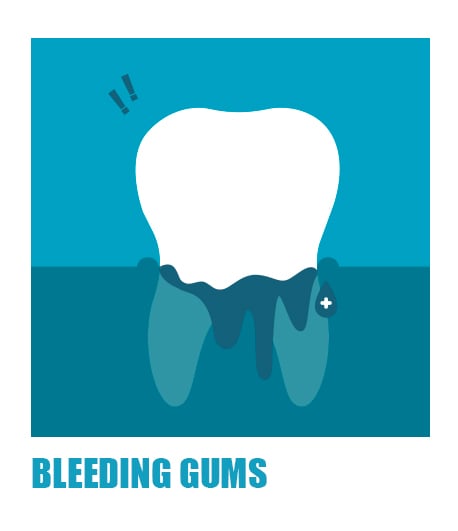 symptoms-of-gum-bleeding-gums