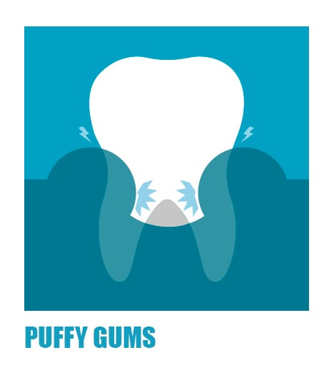 symptoms-of-gum-problems-puffy-gums