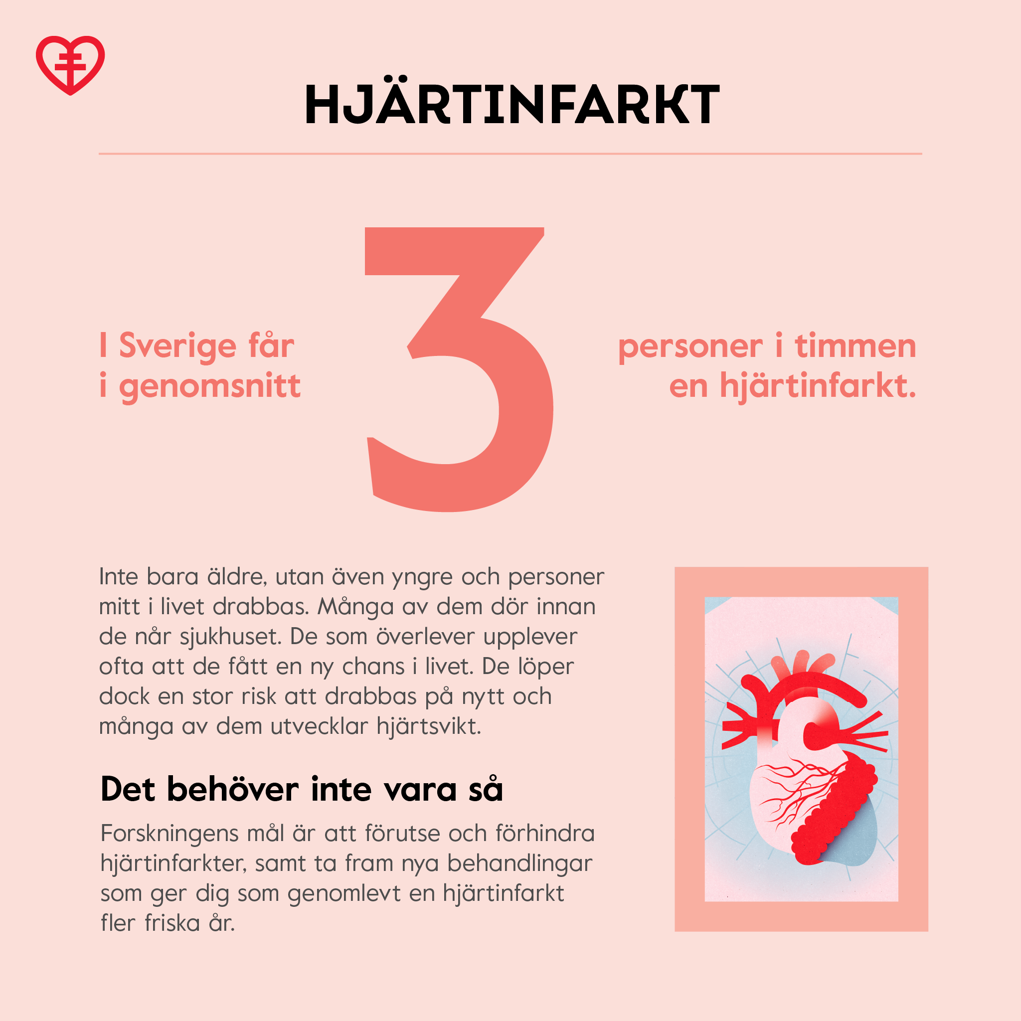 Infografik om hjärtinfarkt