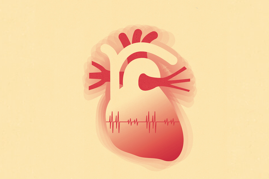Illustration hjärta - hjärtrytmrubbningar
