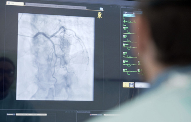 Läkare tittar på hjärtröntgen på dator