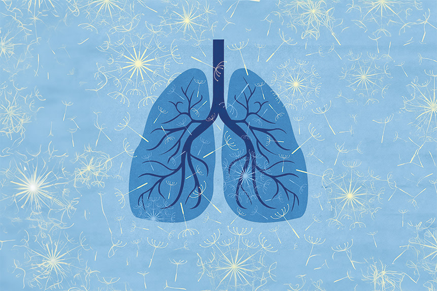Medicinsk illustration på lungor och astma