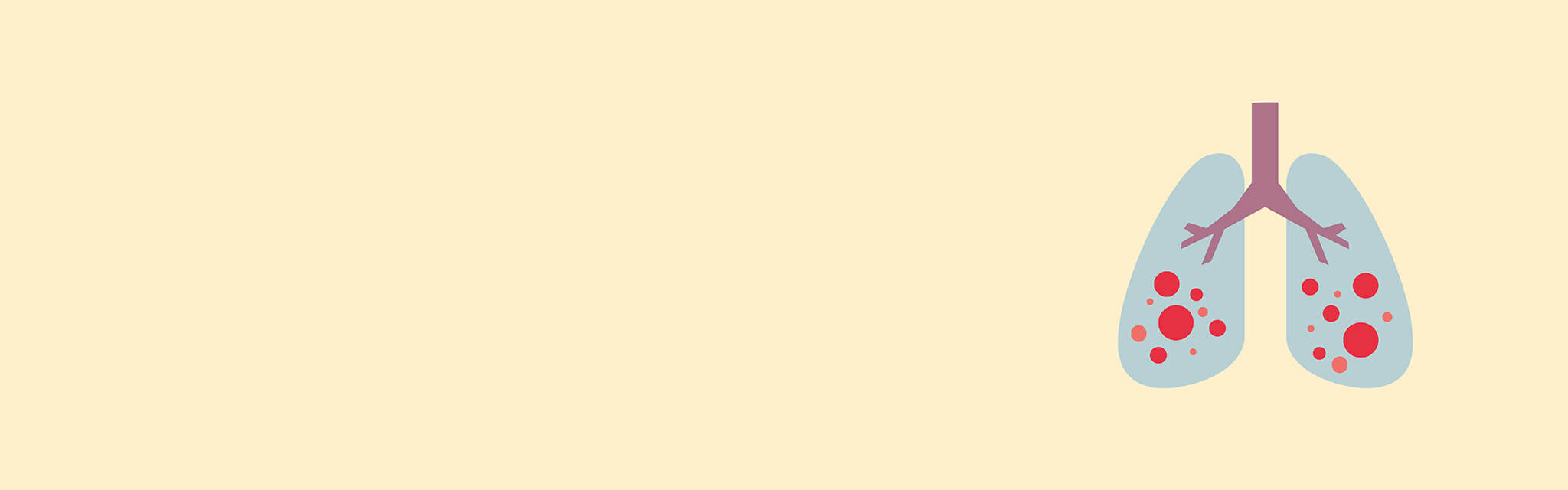 Illustration tuberkulos, lunga.