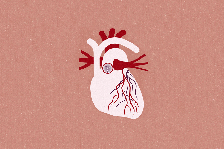 Illustration hjärtklaffsjukdom