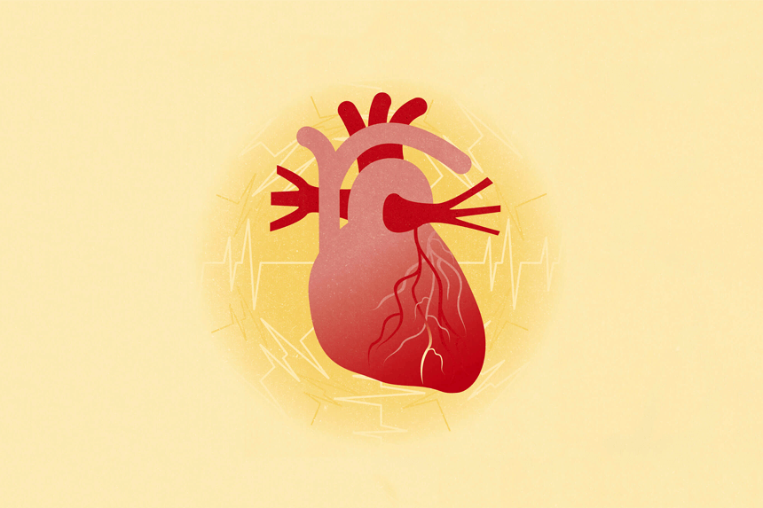 Illustration hjärtsvikt