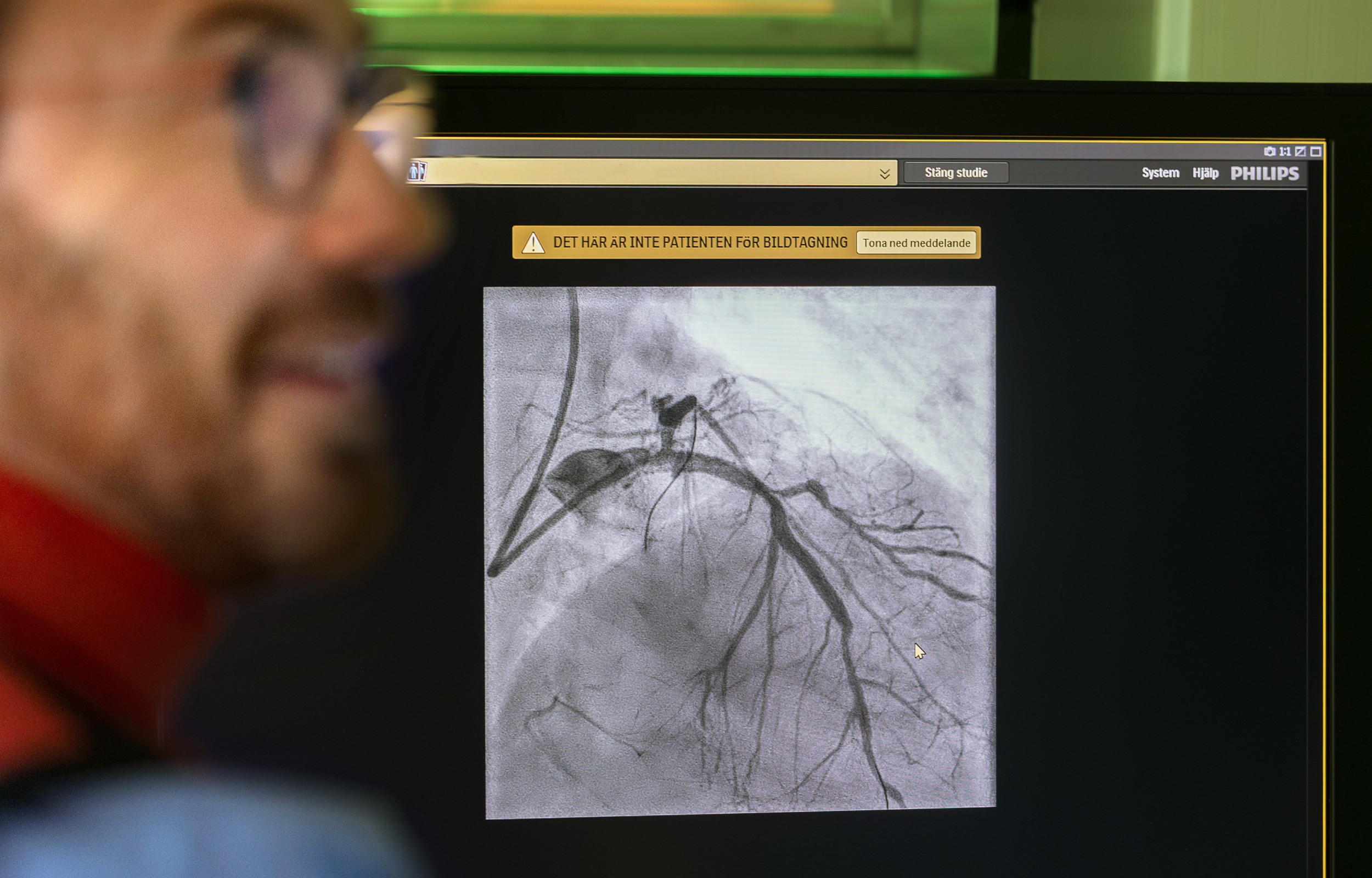 Bild på ballongvidgning