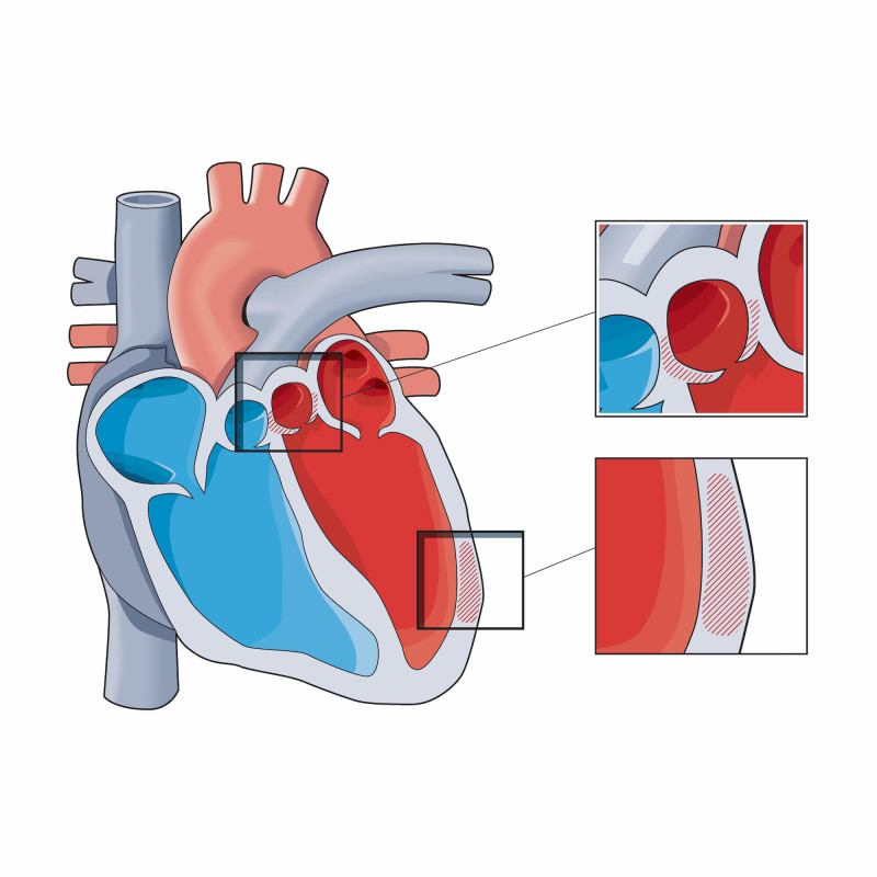 Medicinsk illustration av ett hjärta