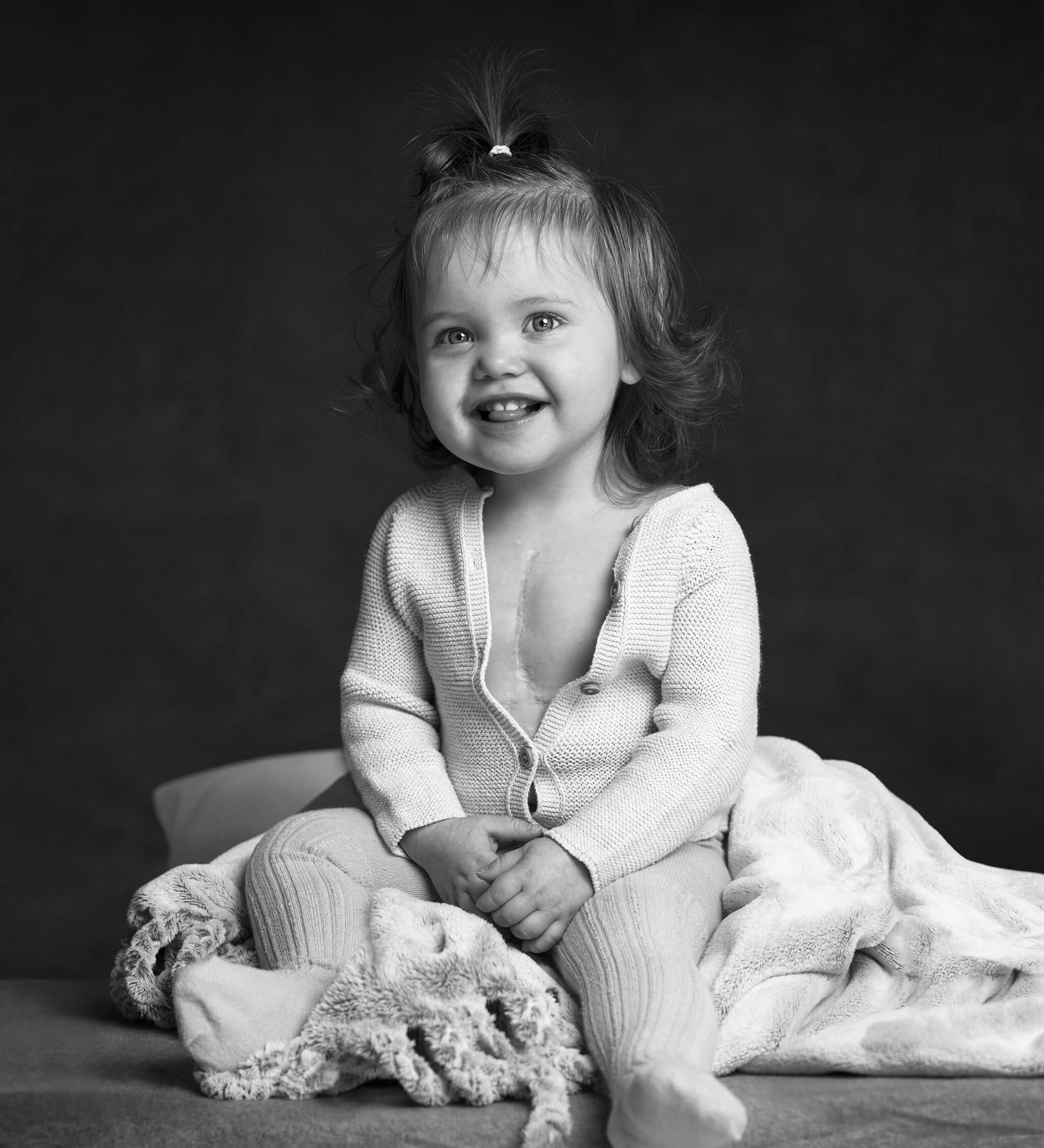 Litet barn med ärr på bröstet sitter på en filt