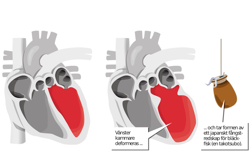Illustration av brustet hjärta av Kjell Thorsson