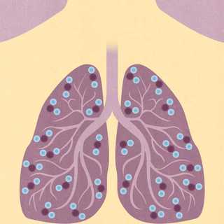 Illustration med lunga som symboliserar lungsjukdomen KOL