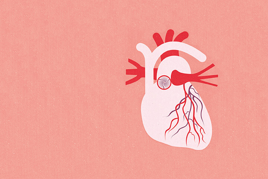 Hjärtklaff i illustration, i rosa färg.