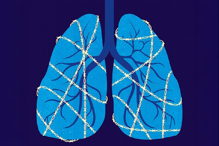 Lungor blåa KOL