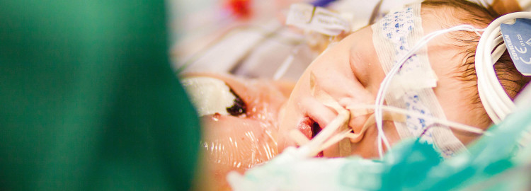 Bebis föds och ligger på operation