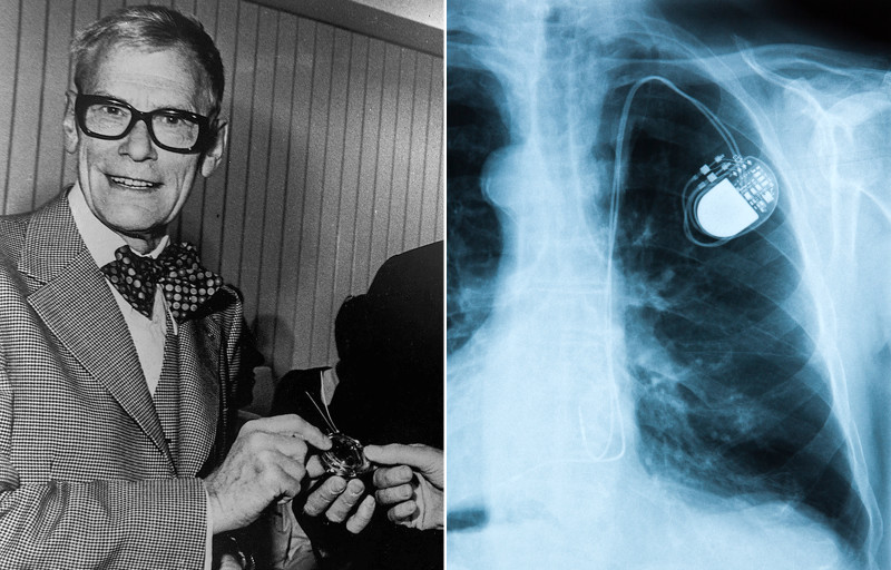 Svensk uppfinnare bredvid röntgenbild på pacemaker.