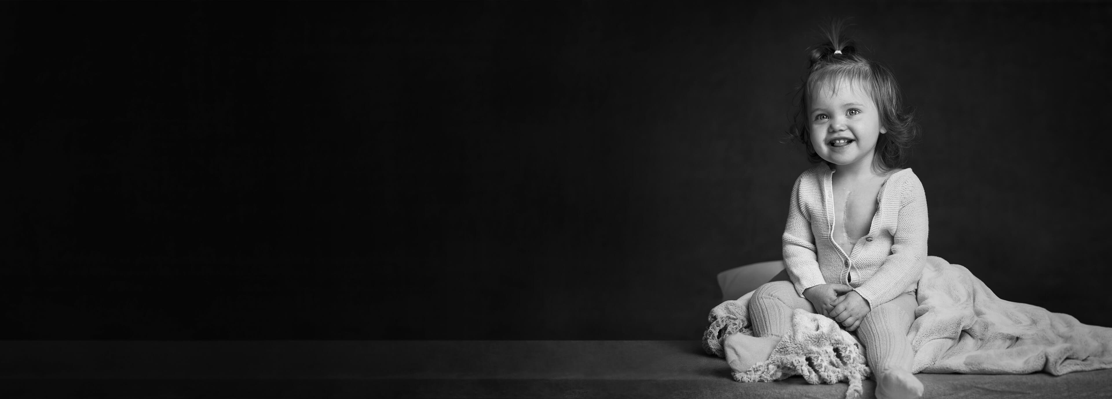 Litet barn med ärr på bröstet sitter på en filt