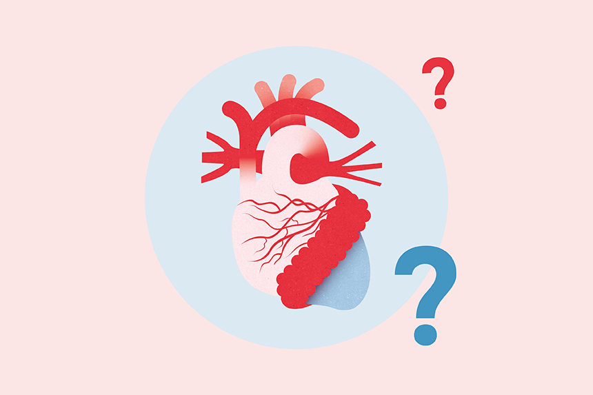 Illustration för frågor om hjärtinfarkt
