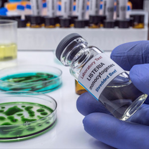 How to Prevent Listeria Infections: Practical Steps to Keep Your Food Safe