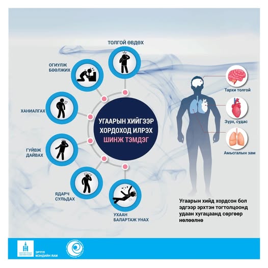 Угаарын хийд хордсон бол удаан хугацаандаа сөргөөр нөлөөлнө‼