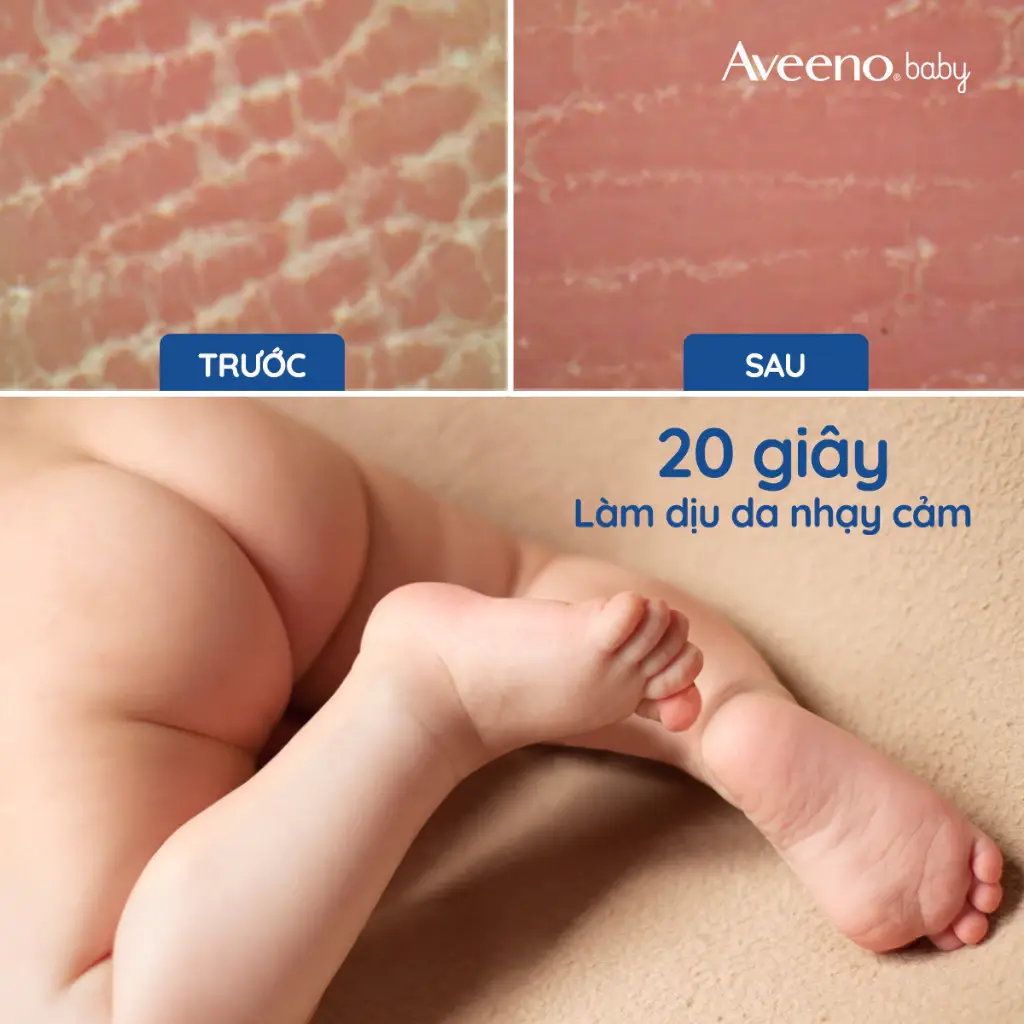 Aveeno Baby Daily Moisture Lotion
