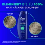 Eliminiert bis zu 100% hartnäckige sichtbare Schuppen; bei regelmäßiger Anwendung