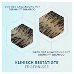 Vorher- und Nachher-Bilder, die den Haarzustand zeigen, mit Ergebnissen in sechseckigen Rahmen, die die klinische Wirksamkeit des DermaX Pro Shampoos betonen.