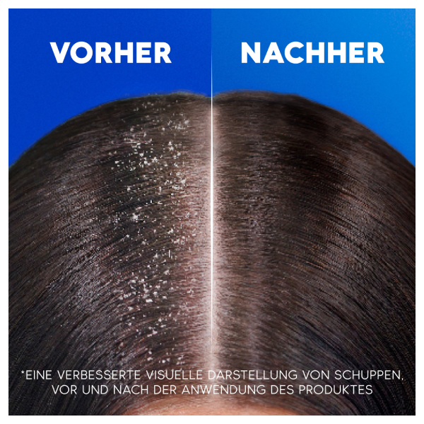 Tea Tree Shampoo Bei Hautproblemen – Mit ätherischen Ölen, 200 Ml, Für Ekzeme, Schuppen & Sensible Kopfhaut