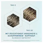 Vergleich einer Kopfhautbehandlung: Tag 0 und Tag 28 mit mikroskopischen Aufnahmen der Haarfollikel