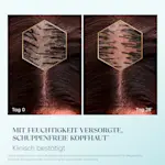 Vergleich der Kopfhaut an Tag 0 und Tag 28: weniger Schuppen und besser mit Feuchtigkeit versorgt.