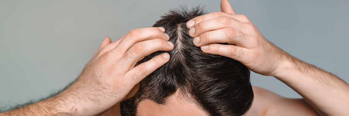 Zwei Hände massieren Shampoo oder eine Kopfhautpflege von oben in das nasse Haar ein.