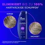 Eliminiert bis zu 100% hartnäckige sichtbare Schuppen; bei regelmäßiger Anwendung