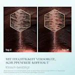 Vergleich einer Kopfhautbehandlung: Tag 0 und Tag 28 mit mikroskopischen Aufnahmen der Haarfollikel