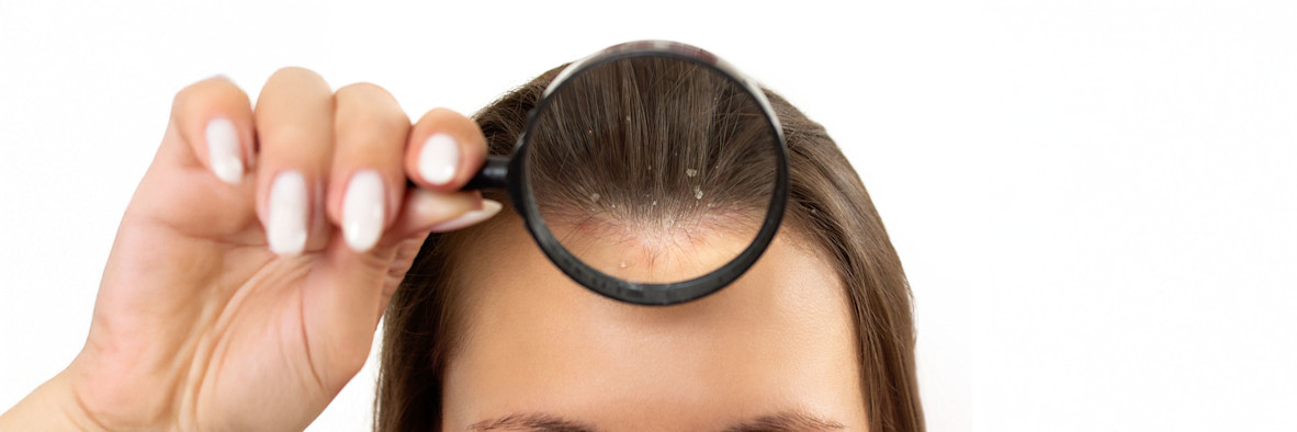 Eine Frau betrachtet ihre Kopfhaut mit einer Lupe.