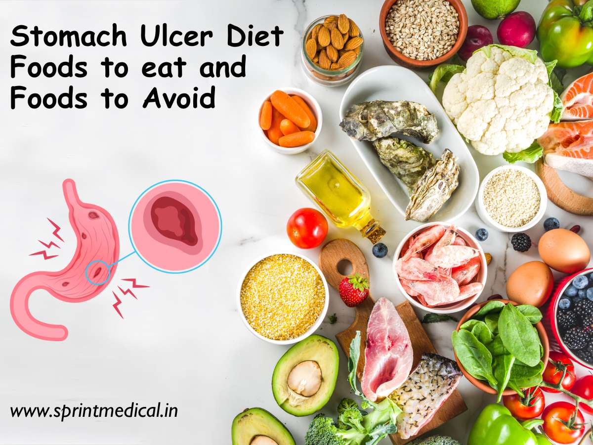 Stomach Ulcer Diet Foods to eat and Foods to Avoid