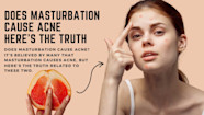 Does Masturbation Cause Acne Here s The Truth Sprint Medical