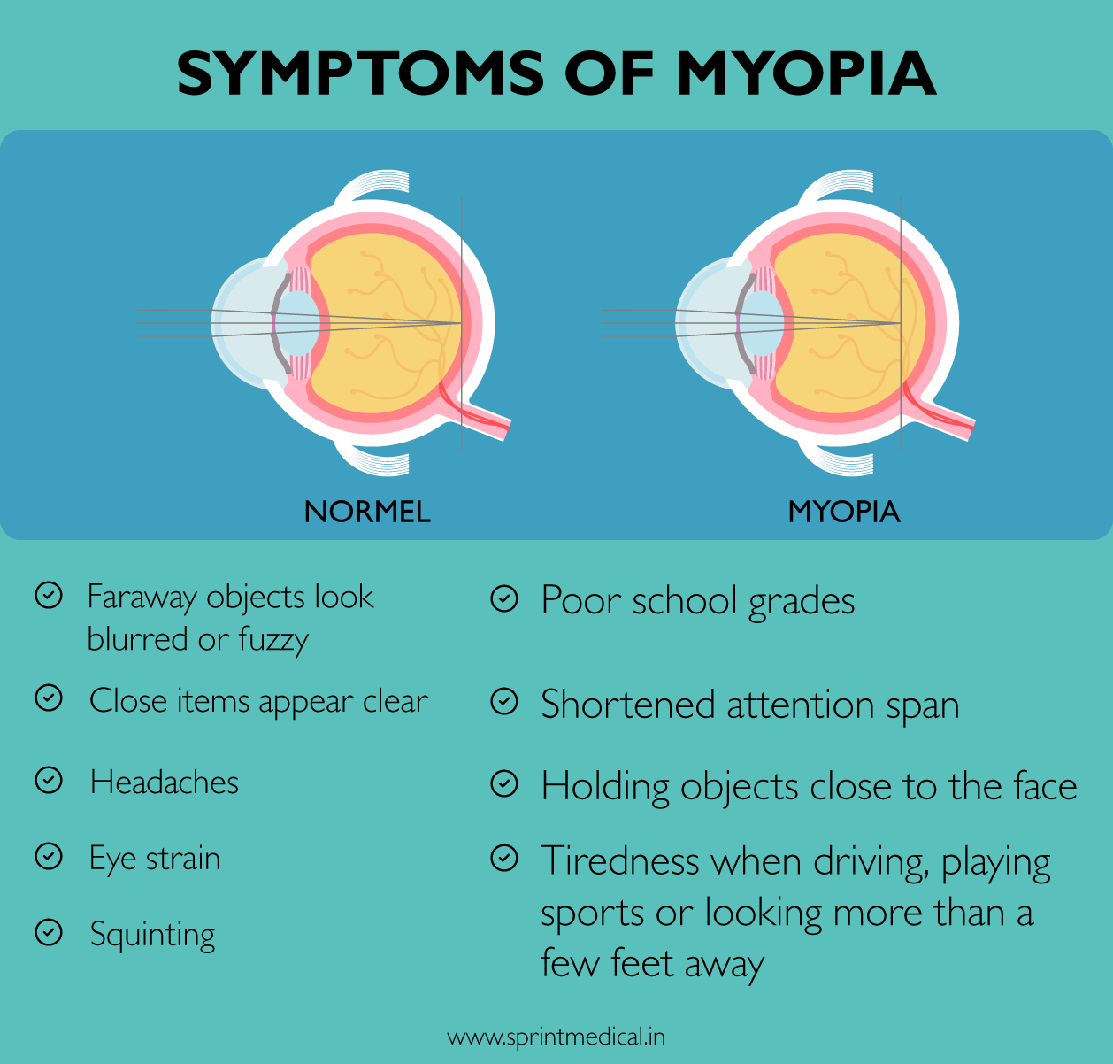 What Is Myopia? What Are The Symptoms Of Myopia? | BULB