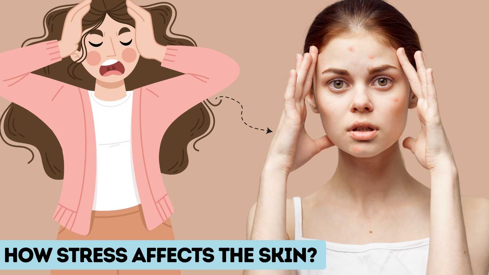 How stress affects the Skin