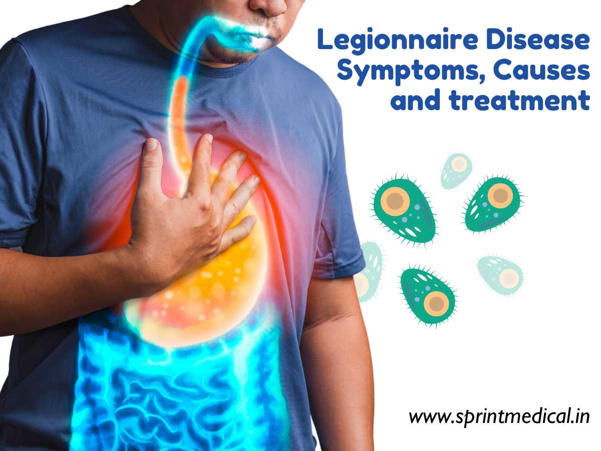 Legionnaire Disease Symptoms, Causes and treatment