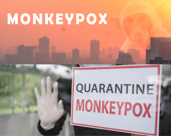 Monkeypox Virus- Outbreak, Symptoms, Treatment, Vaccine and Prevention