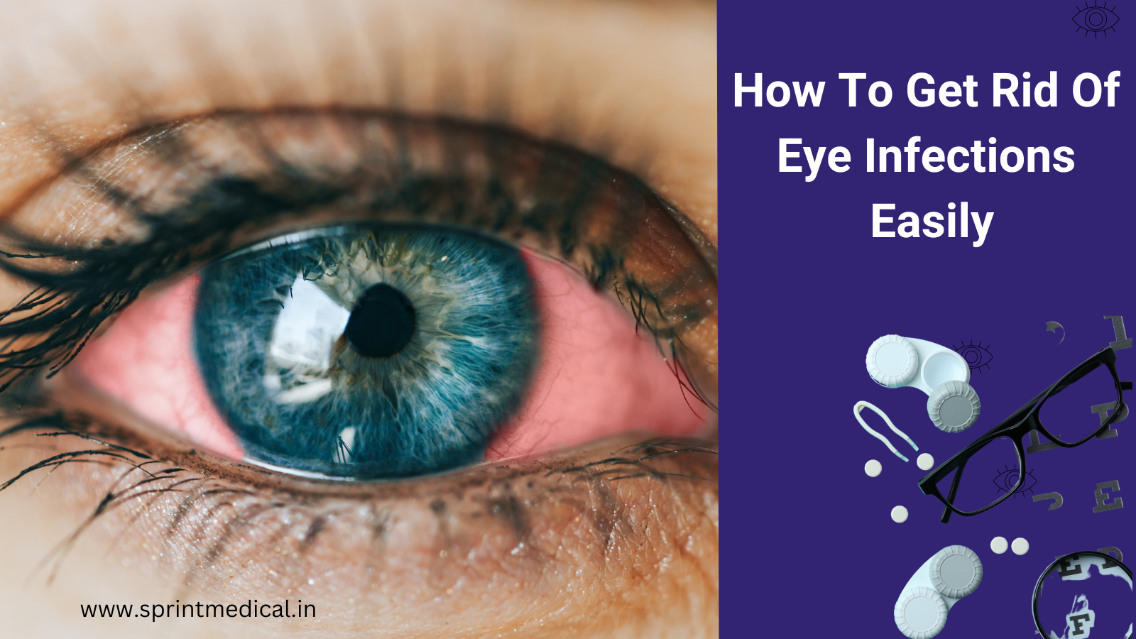 How To Get Rid Of Eye Infections Easily